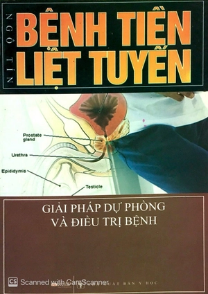 bệnh tiền liệt tuyến giải pháp dự phòng và điều trị bệnh - Ảnh 2