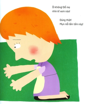 bộ các bệnh thường gặp tập 5: bệnh chân tay miệng và bệnh liên cầu khuẩn là gì? - Ảnh 4