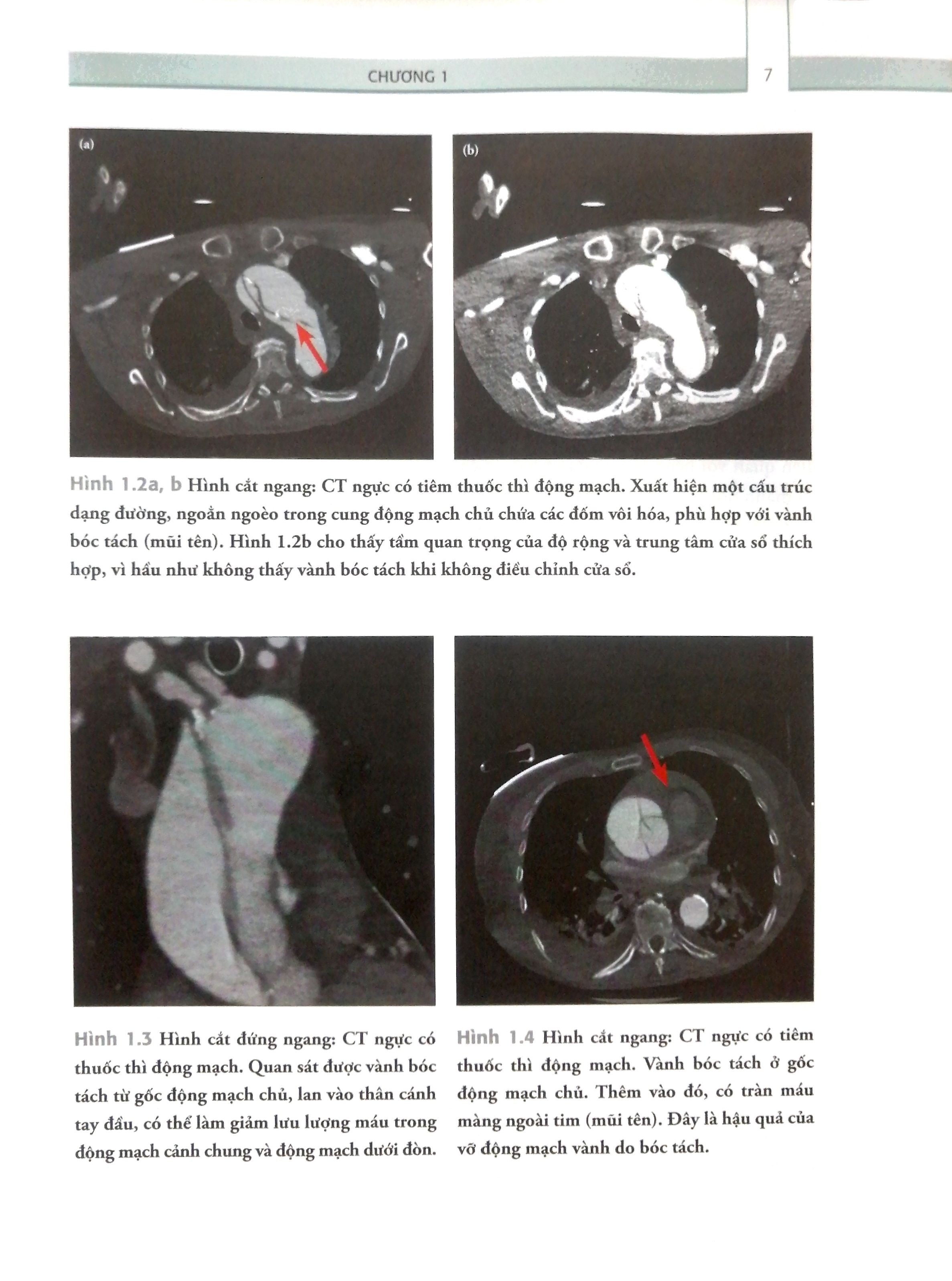 cẩm nang trực chuẩn đoán hình ảnh - Ảnh 5