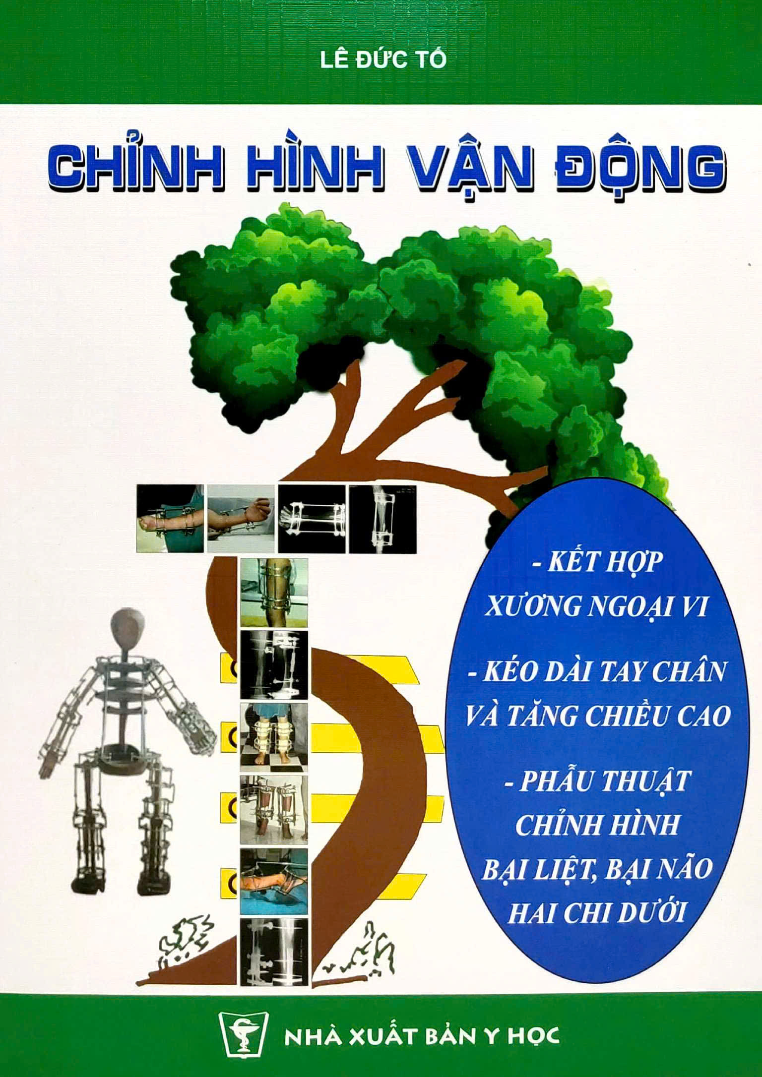 Chỉnh Hình Vận Động - Ảnh 2