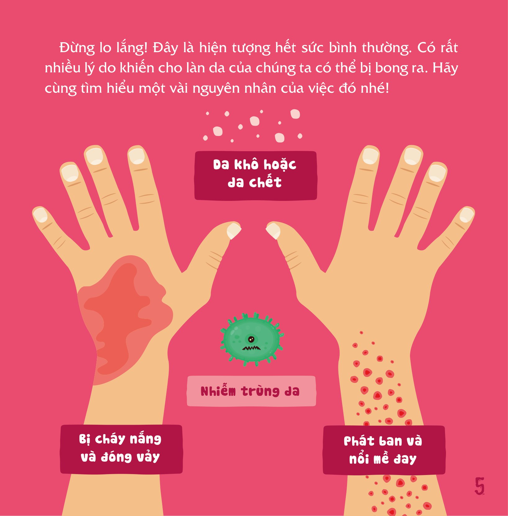 có thể bạn chưa biết - vì sao chúng ta... bị bong da? - Ảnh 6