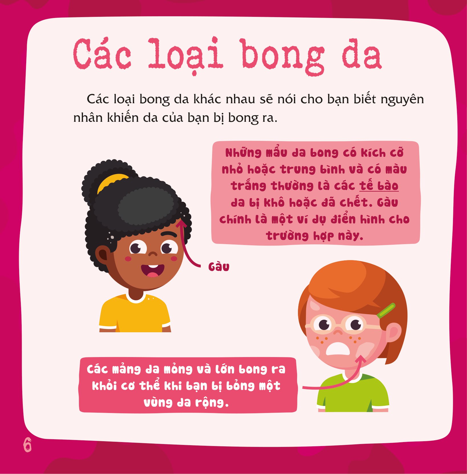 có thể bạn chưa biết - vì sao chúng ta... bị bong da? - Ảnh 7