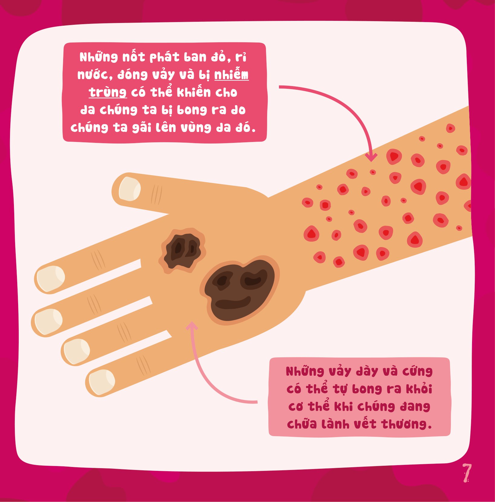 có thể bạn chưa biết - vì sao chúng ta... bị bong da? - Ảnh 8