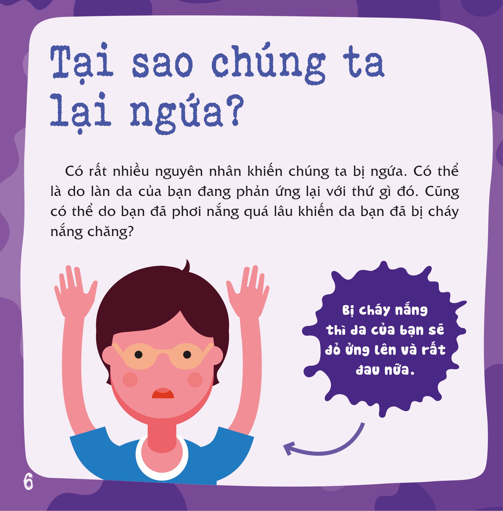 có thể bạn chưa biết - vì sao chúng ta... bị ngứa? - Ảnh 7