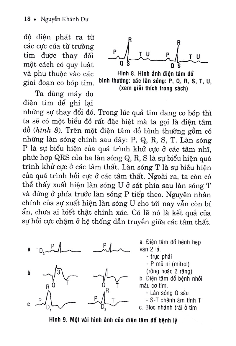 hiểu biết để phòng và trị bệnh tim mạch - Ảnh 17