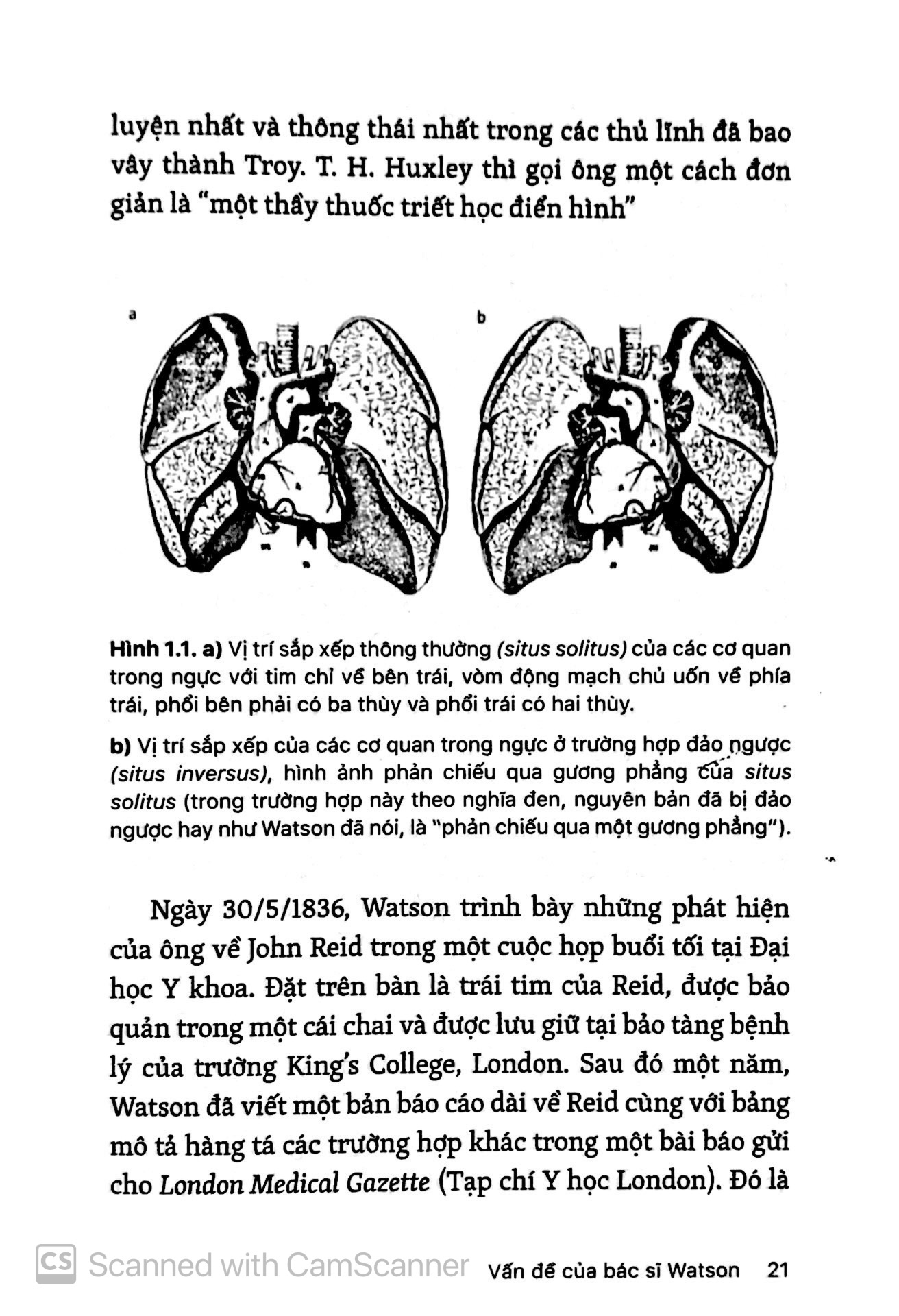 những bí ẩn của tay phải và tay trái - Ảnh 6