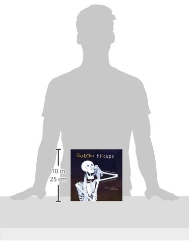 skeleton hiccups - Ảnh 2