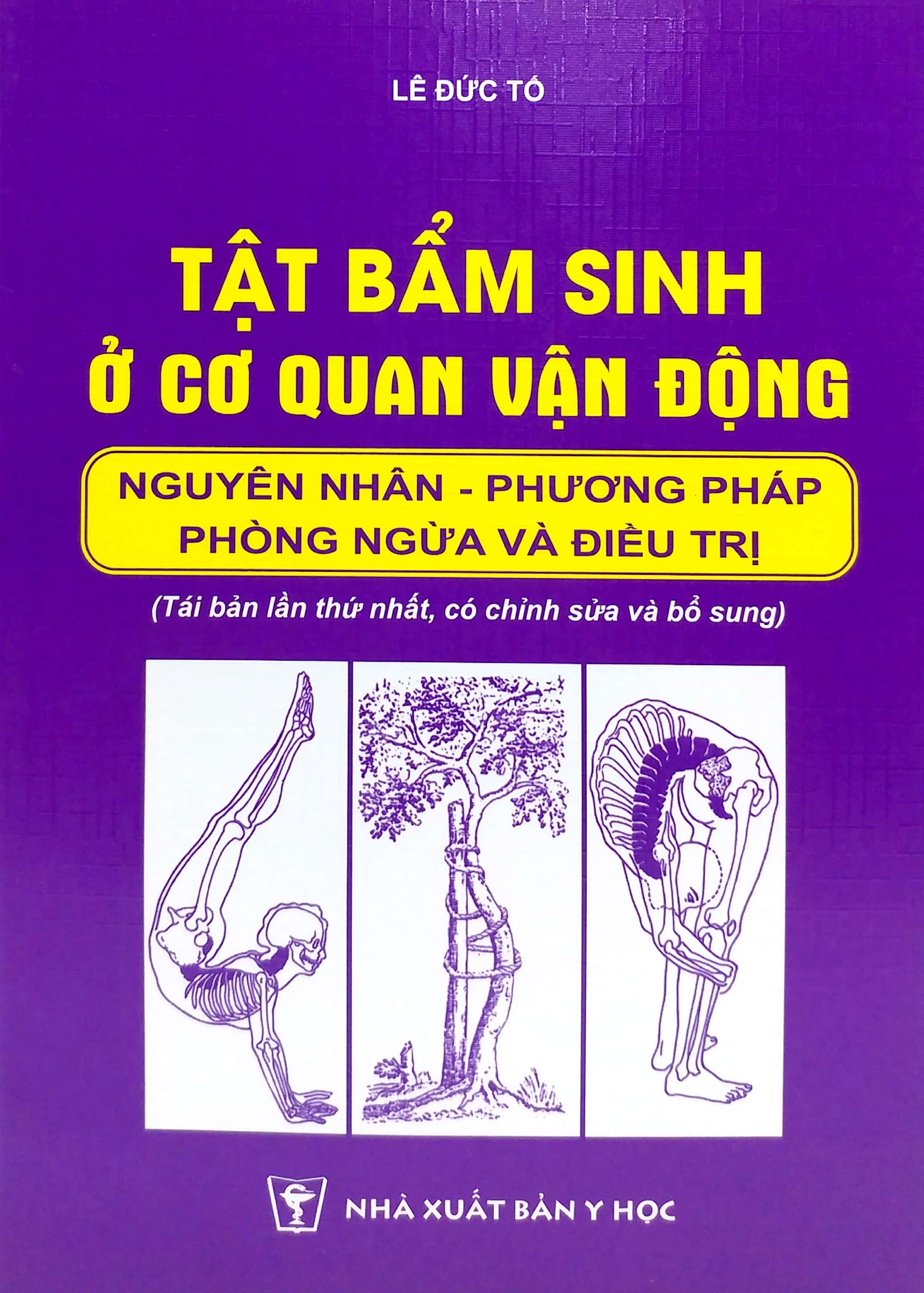 tật bẩm sinh ở cơ quan vận động - nguyên nhân - phương pháo phòng ngừa và điều trị (tái bản 2024) - Ảnh 2