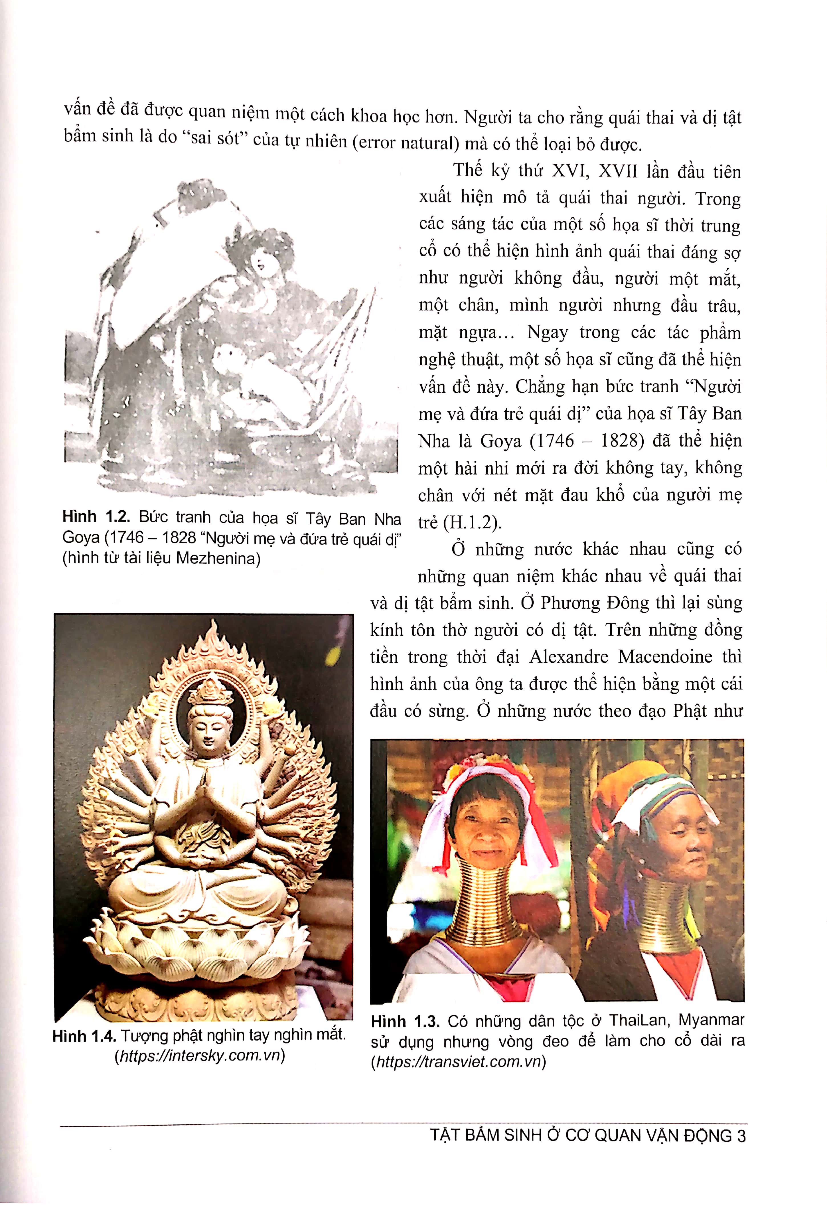 tật bẩm sinh ở cơ quan vận động - nguyên nhân - phương pháo phòng ngừa và điều trị (tái bản 2024) - Ảnh 5