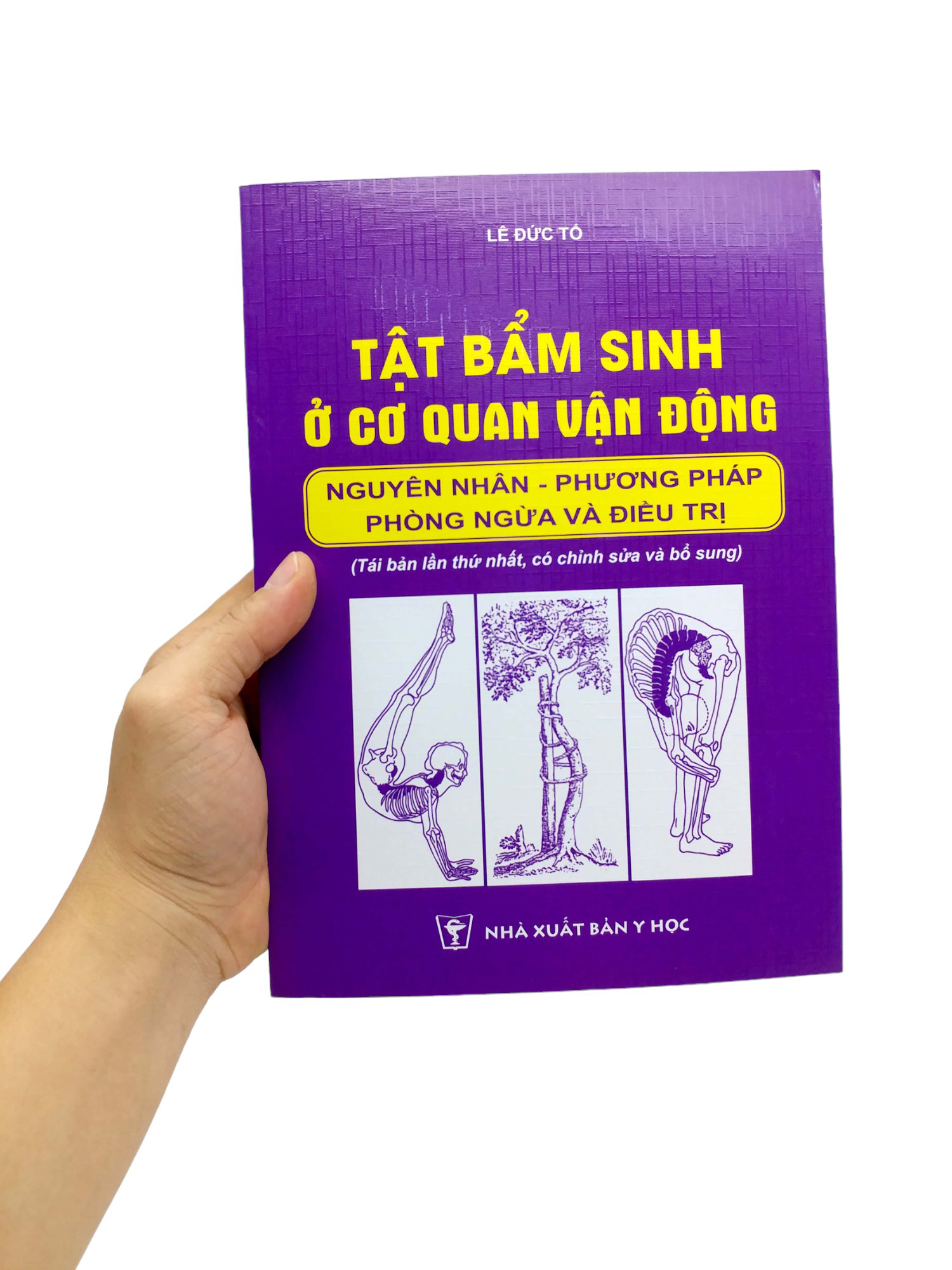 tật bẩm sinh ở cơ quan vận động - nguyên nhân - phương pháo phòng ngừa và điều trị (tái bản 2024) - Ảnh 7