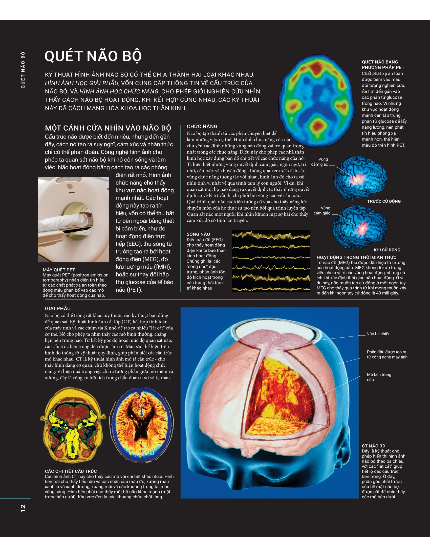 the brain book - não chúng ta có gì và làm gì? - bìa cứng - Ảnh 12