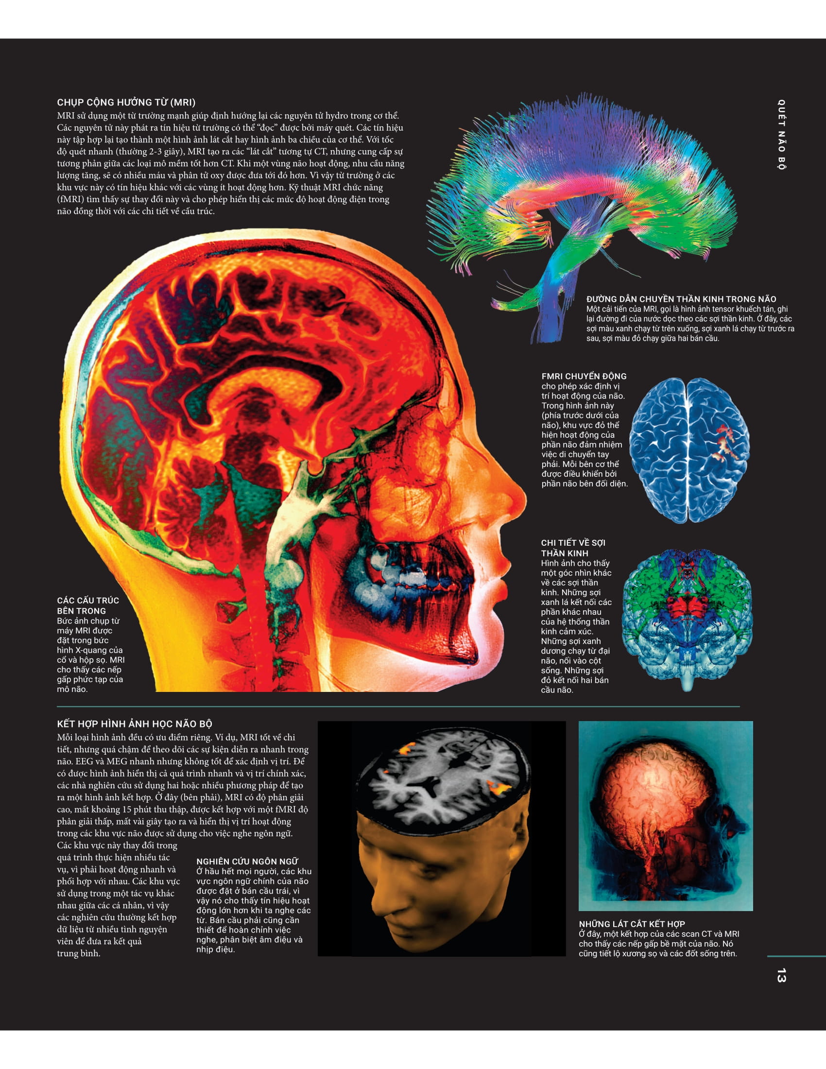 the brain book - não chúng ta có gì và làm gì? - bìa cứng - Ảnh 13