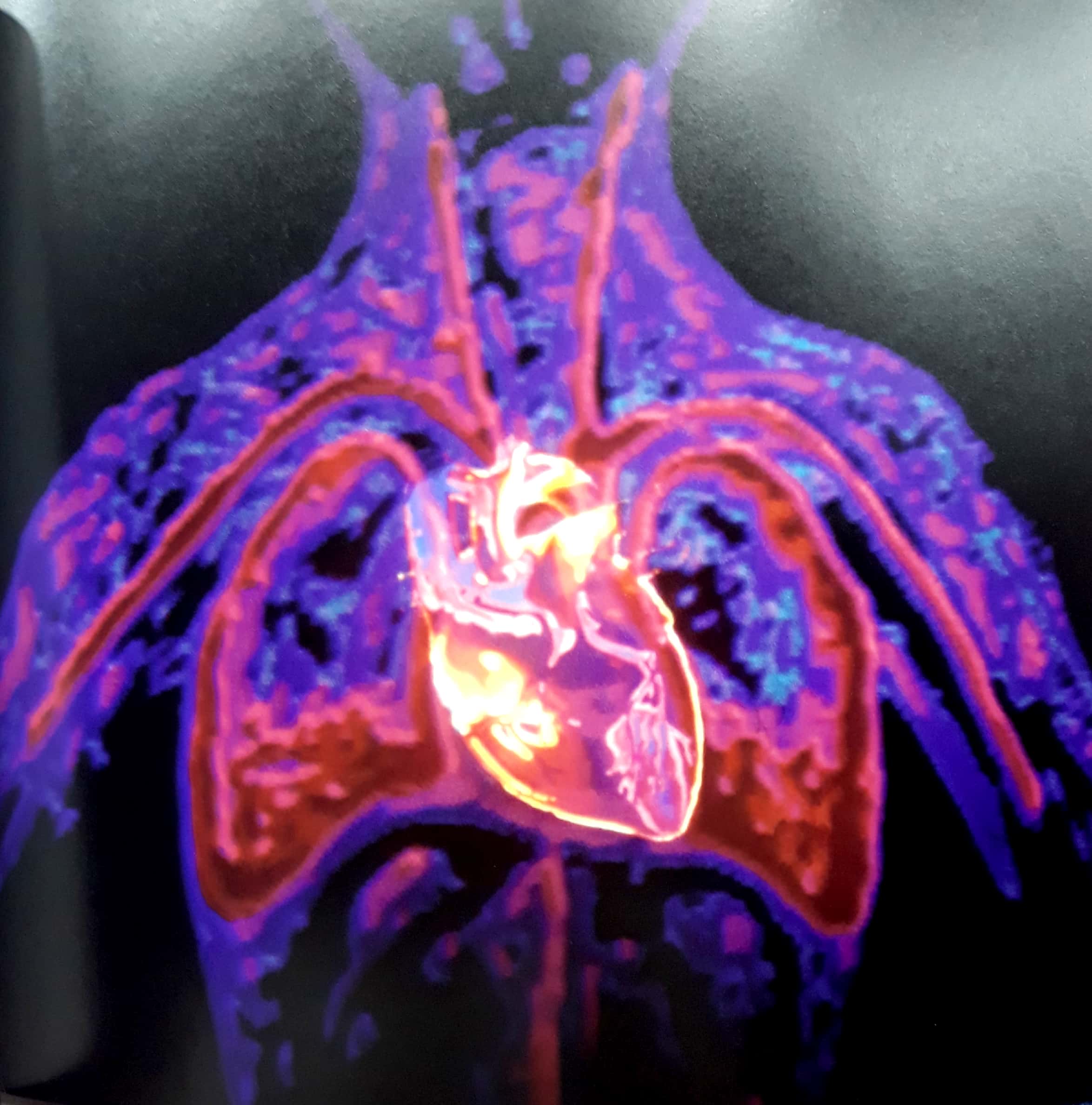 the heart: our circulatory system - Ảnh 5