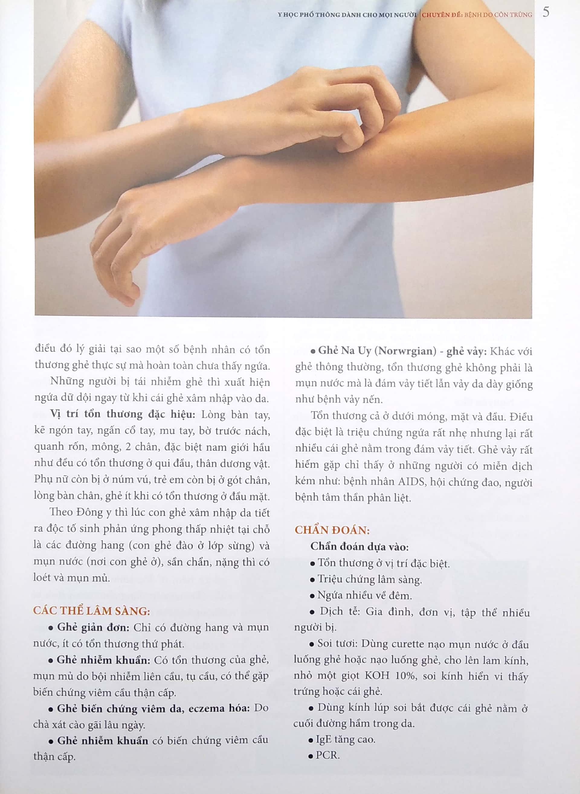 y học phổ thông dành cho mọi người - chuyên đề: bệnh do côn trùng - Ảnh 6
